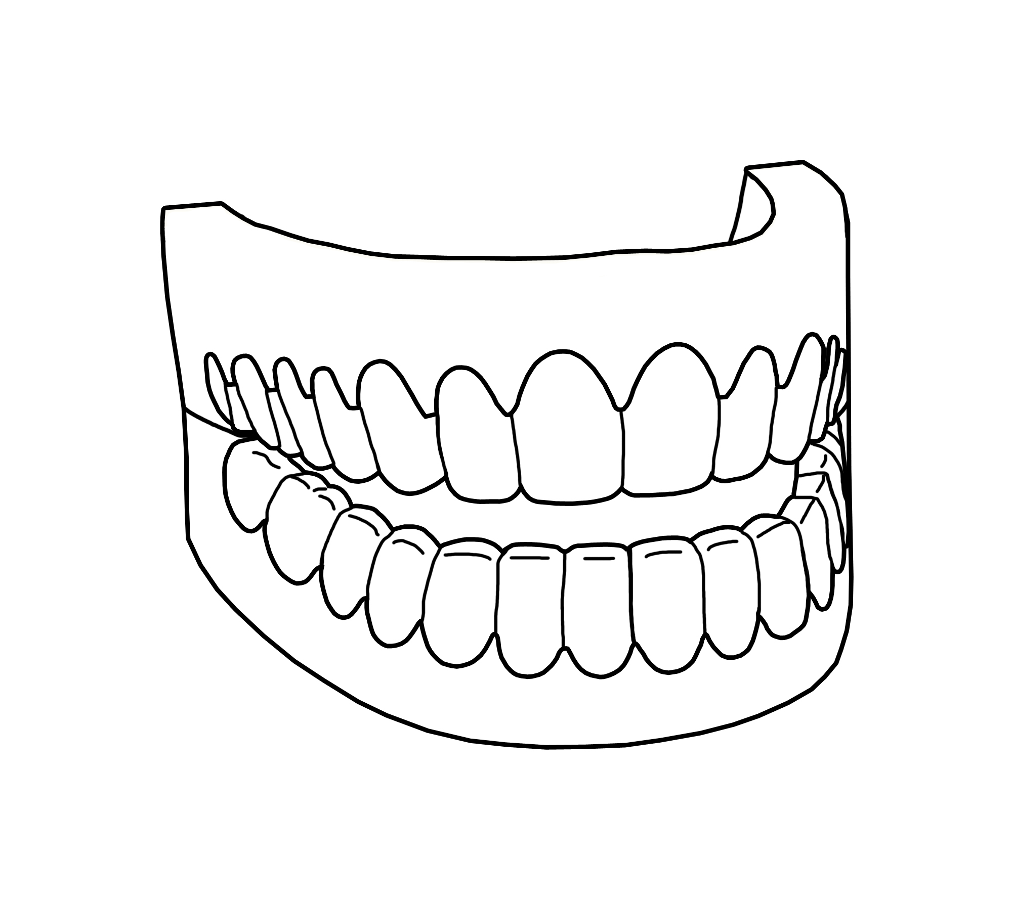 Dentist And Kid Dental Braces Coloring Pages Page Teeth Educations 2000x1800 Dentist And Kid Dental Braces Coloring Pages Page Teeth Educations