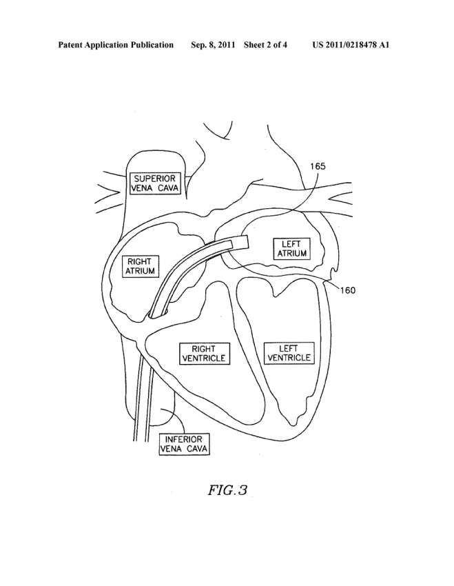 659x850 Cardiovascular System Coloring Pages Cardiovascular System