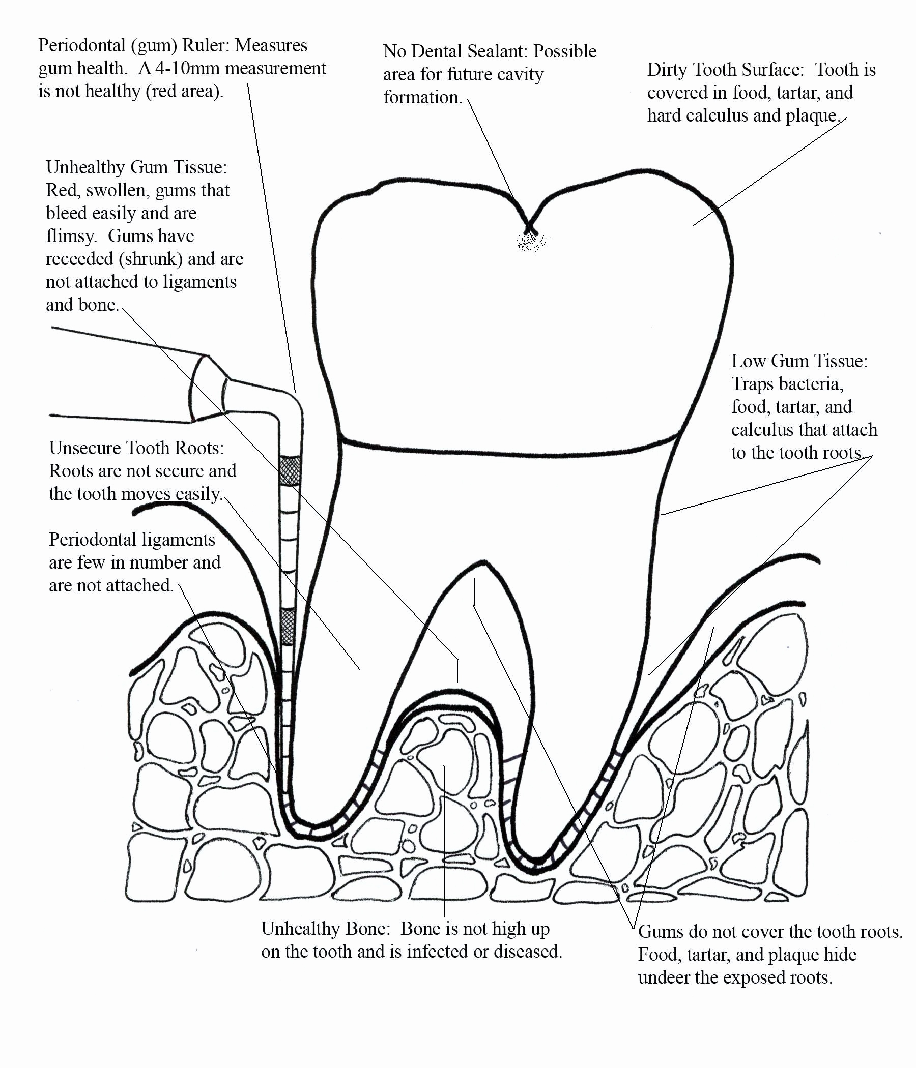 1800x2100 49 Elegant Image Of Tooth Coloring Pages